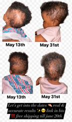 Natural Hair Oil for Hair Growth, Strength & Moisture