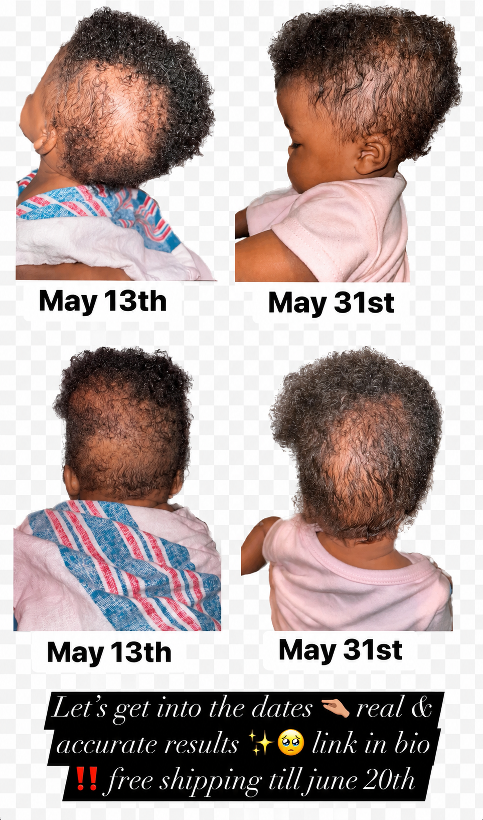 Natural Hair Oil for Hair Growth, Strength & Moisture