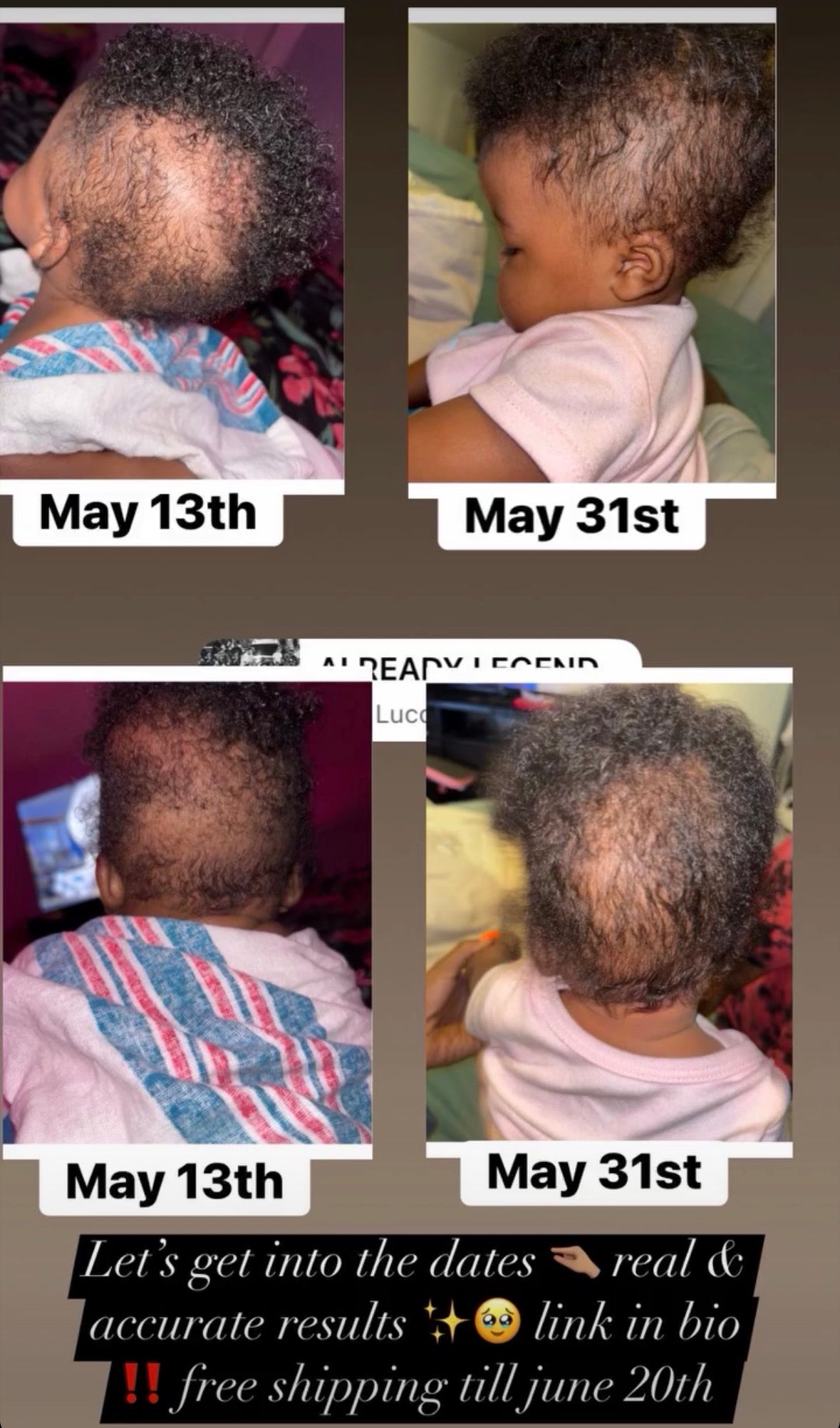 Natural Hair Growth Oil | Promote Healthier, Stronger Hair