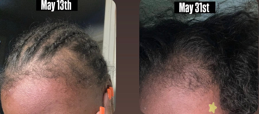 Natural Hair Oil for Hair Growth, Strength & Moisture