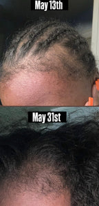 Natural Hair Growth Oil | Promote Healthier, Stronger Hair